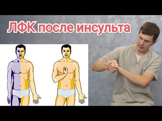 Упражнения для руки после инсульта - ЛФК при инсульте, парезе