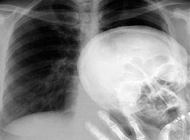 Виталий Беляев | Вологда