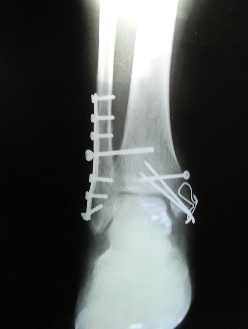 Александра Гешель KorsiDaoDe | Москва