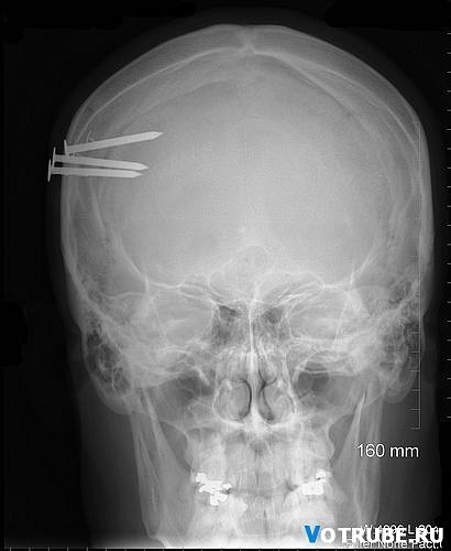 №18, Libor Podmol №18, Libor Podmol