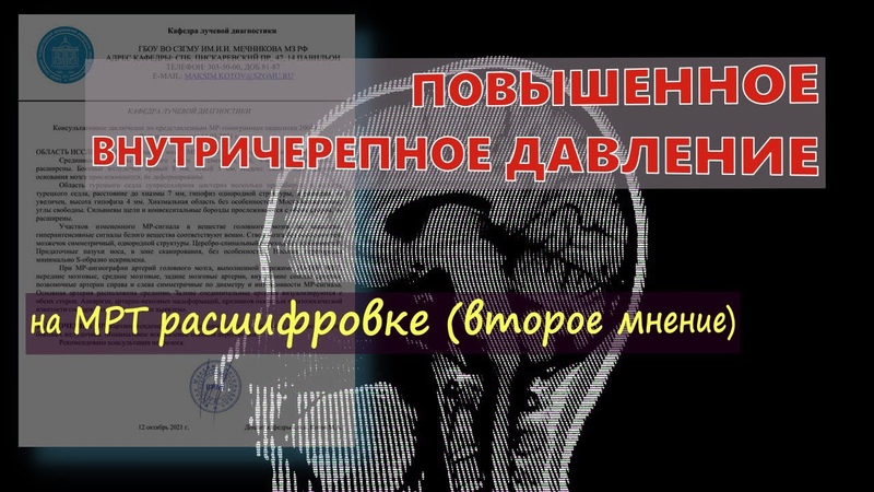 Давление на мрт. Повышенное давление мрт. Магнитно-резонансная томография принцип метода. Повышенное давление мрт. Принцип работы томографа.